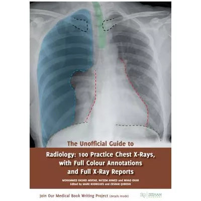 Unofficial Guide to Radiology: 100 Practice Chest X Rays with Full Colour Annotations and Full X Ray Reports
